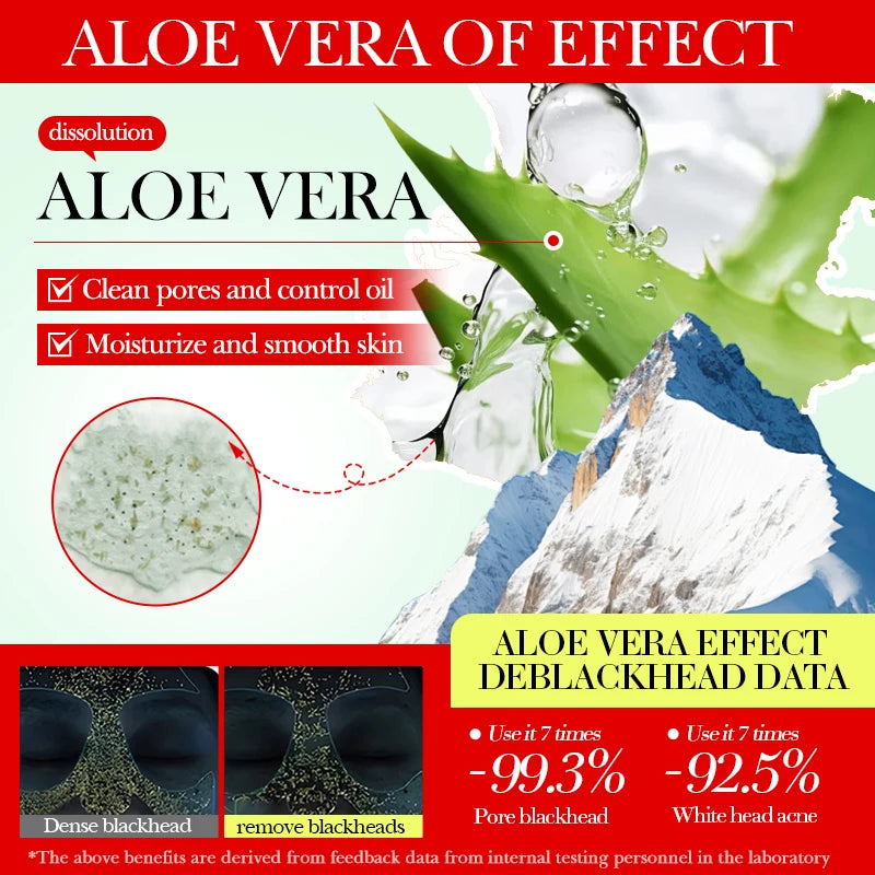 5pcs SADOER Aloe vera Face Mask Mud Masks Facial Moisturizing