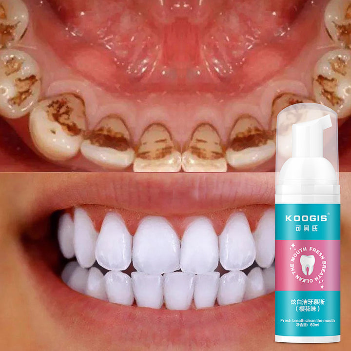 Teeth Mousse