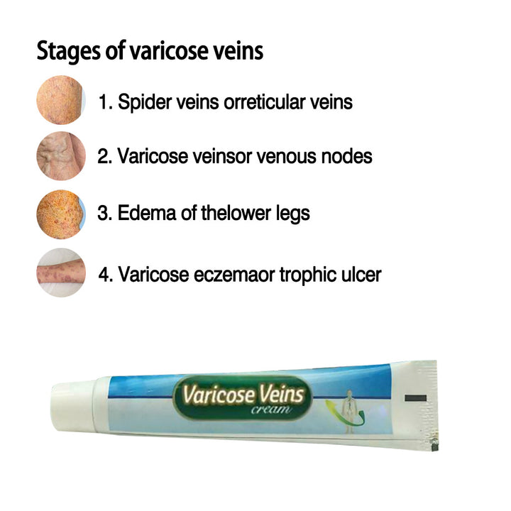 Varicose Cream