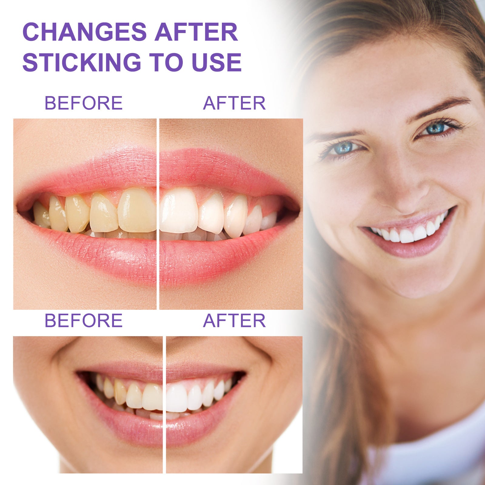 Whitening Teeth Removal