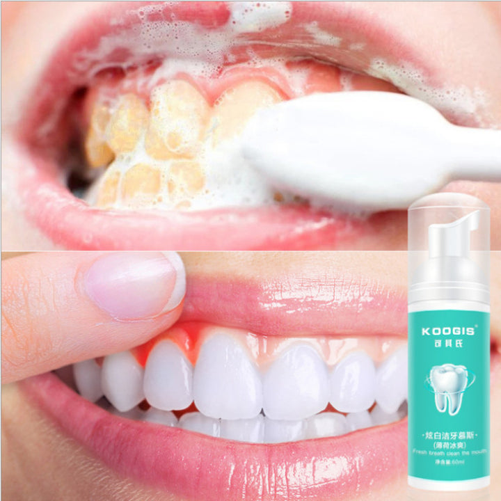 Teeth Mousse